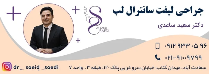 سانترال لب چیست