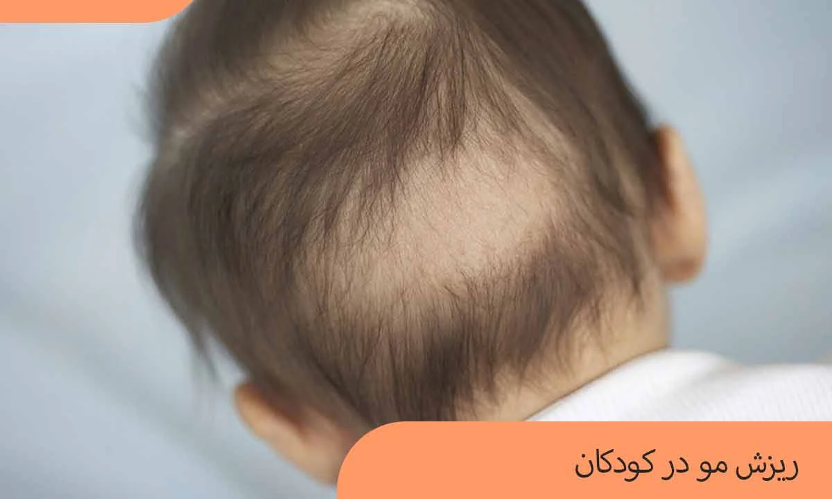 کمبود این ویتامین ها باعث ریزش مو در کودکان میشود