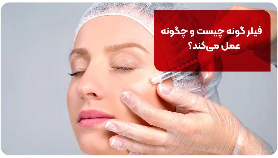 فیلر گونه چیست و چگونه عمل می&zwnj;کند؟