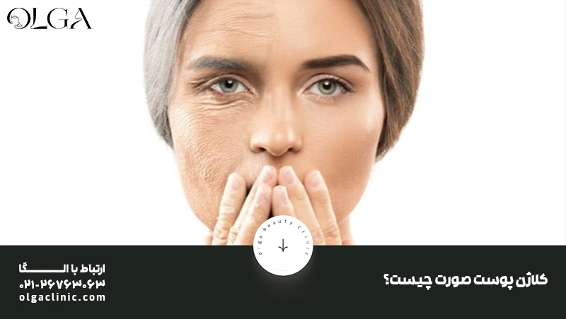 تغذیه | تغذیه مناسب کلاژن پوست صورت چیست؟