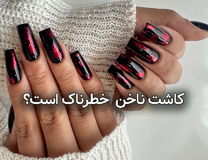 اینستاگرام | عفونت کاشت ناخن خطرناک است؟ پاسخی که باید بدانید